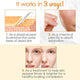 Bye Bye Blemish Vitamin C Gel Exfoliator, Gentle Facial Cleanser for Brightening and Blemishes, 8 fl oz