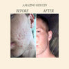 African Black Soap - Eliminate Acne | Pimples and Acne Scars | Regenerates the skin | Deep - Image 5