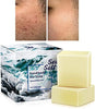 Sea Salt Soap 3.5 Oz Each, Exfoliating Acne Deeply Clean Problem Skin, Natural Goat's Milk - Image 1
