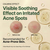 Centella Serum with 494,700 ppm Centella Asiatica, Unscented Soothing Ampoule for Acne-Pro - Image 3