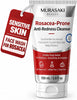 Rosacea Treatment for Face Anti-Redness Cleanser 150 mL / 5.07 fl oz - Personal Care - Image 1