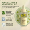 Centella Serum with 494,700 ppm Centella Asiatica, Unscented Soothing Ampoule for Acne-Pro - Image 2