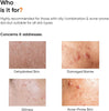 Minimalist Panthenol (Vitamin B5) 10% Face Moisturizer for Oily & Acne Prone Skin | For De - Image 3