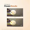 Ginseng Exosome First Essence | Hydrating, Targets Wrinkle & Dullness, Dark Spot Remover,  - Image 3