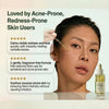 Centella Serum with 494,700 ppm Centella Asiatica, Unscented Soothing Ampoule for Acne-Pro - Image 5