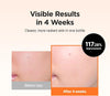 Isntree Hyper Vitamin C 23 Serum | 23% Pure Vitamin C + Vitamin E & Panthenol for Face bea - Image 5