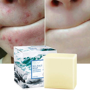 Soap with Sea Salt Natural Goat's Milk for Face Dry and Natural Oily Skin, Remove Acne Anti-cellulite Soap (3.52 Oz) - Personal Care