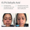Mdacne Hydrating Facial Cleanser with 0.5% Salicylic Acid - Personal Care - Image 3
