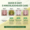 Some BY MI Bye Blackhead 30 Days Miracle Green Tea Tox Bubble Cleanser – 4.23oz, 120g – Ko - Image 5