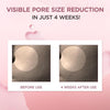Skin1004 Centella Poremizing Fresh Ampoule 1.69 fl.oz, 50ml, Korean Pink Serum for Enlarge - Image 3