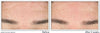 Roc Derm Correxion Serum Facial Cleanser with Niacinamide and Amino Acids - Personal Care - Image 3