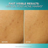 L'Oreal Paris Bright Reveal Dark Spot Exfoliant Peel, 25% AHA BHA PHA Face Exfoliator Solu - Image 3