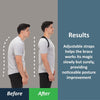 ComfyBrace Posture Corrector for Men and Women, Back Brace Straightener - Image 2