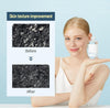 Round LAB 1025 Dokdo Toner + Dokdo Lotion Set | Gentle Exfoliating Dead Skin Cells Without - Image 5