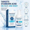 Hermon Benzoyl Peroxide Body Wash: 10% Benzoyl Peroxide Acne Wash for Face, Skin, Butt, an - Image 4