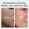 Geologie 2% Salicylic Acid Unscented Face Wash | Fragrance-Free Facial Cleanser for Men &  - Image 3