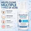 Hermon Benzoyl Peroxide Body Wash: 10% Benzoyl Peroxide Acne Wash for Face, Skin, Butt, an - Image 5