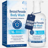 Hermon Benzoyl Peroxide Body Wash: 10% Benzoyl Peroxide Acne Wash for Face, Skin, Butt, an - Image 1