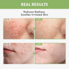 Tosowoong Heartleaf 97% Face Toner for Blemish-Prone & Calming, Hydrating - Personal Care - Image 2