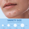 Daolyo Pimple Patches for Face, 4 Size 300 Counts Hydrocolloid Acne Patches - Image 3