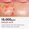 Tosowoong Salicylic Acid BHA Foam Cleanser for Oily Skin, Pores - Personal Care - Image 3