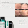 Some BY MI AHA BHA PHA 30Days Starter Kit - Toner 1.01Oz, Serum 0.33Oz, Cream 0.7Oz, Clean - Image 5