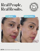 Kate Somerville - Personal Care - Image 5