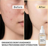Dewy Rice Glow Serum Korean Face Serum, 1 fl.oz - Personal Care - Image 3