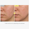 Tosowoong Honey Glow 65% Propolis Serum for Soothing & Uneven Tone, Barrier - Personal Car - Image 3