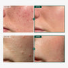Tosowoong Madagascar Centella 86% Cica Ampoule for Soothing & Calming - Personal Care - Image 2