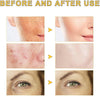 2Pcs GOCAYRRY Advanced Snail Mucin 96% Power Repairing Essence, Snail Mucin 96% - Anti-Agi - Image 2