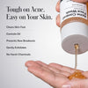 Geologie Acne Control Face Wash | 2% Salicylic Acid Exfoliating Cleanser | Clears Skin, Co - Image 2