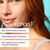 Tula So Poreless Exfoliating Blackhead Facial Scrub, 2.89 oz - Personal Care - Image 5