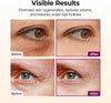 Dr.Melaxin Collagen Multi Balm Stick, Calcium & Adenosine Korean Wrinkle Stick for Eye, Ne - Image 4