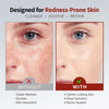 Rosacea Treatment for Face Anti-Redness Cleanser 150 mL / 5.07 fl oz - Personal Care - Image 2