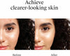Neutrogena Rapid Clear Stubborn Acne Spot Treatment Gel, 1 oz - Image 3