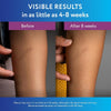 Scaraway Silicone Scar Gel, Helps Improve Size, Color & Texture of Hypertrophic & Keloid S - Image 4