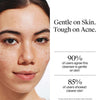 Neutrogena Oil Free Acne Face Wash, Fragrance Free, 9.1 fl oz - Personal Care - Image 5