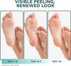 DERMORA Foot Peel Mask | Skin Exfoliating Foot Masks for Dry, Cracked Feet & Callus Remova - Image 3