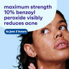Clean & Clear Persa-Gel 10 Acne Spot Treatment, 1 fl. oz - Image 2