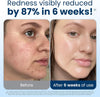 Clean SKIN CLUB - Personal Care - Image 3