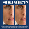 L'Oreal Paris Revitalift 0.3% Pure Retinol Night Serum, Reduce Deep Wrinkles, Fragrance Fr - Image 3