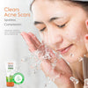 Vlcc Acne Serum Face Wash - Facial Cleanser with Salicylic Acid - Gentle Acne Face Wash fo - Image 3