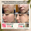 Centella Asiatica Serum - Redness Calming, 38% Cica Leaf Water, 1 fl oz - Personal Care - Image 3