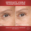 L'Oreal Paris Revitalift Triple Power Anti-Aging Eye Cream, Pro Retinol, Hyaluronic Acid & - Image 5