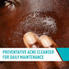 Cerave Acne Control Cleanser, Face Wash with 2% Salicylic Acid, 16 oz - Personal Care - Image 4